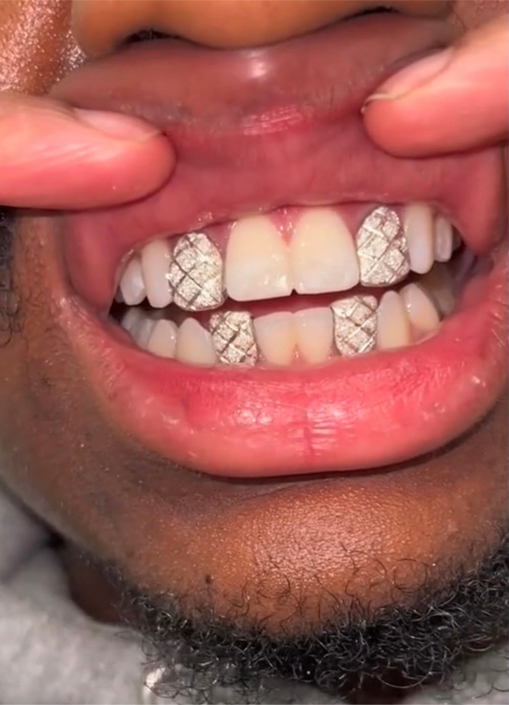 Silver Diamond Dust Cut Caps