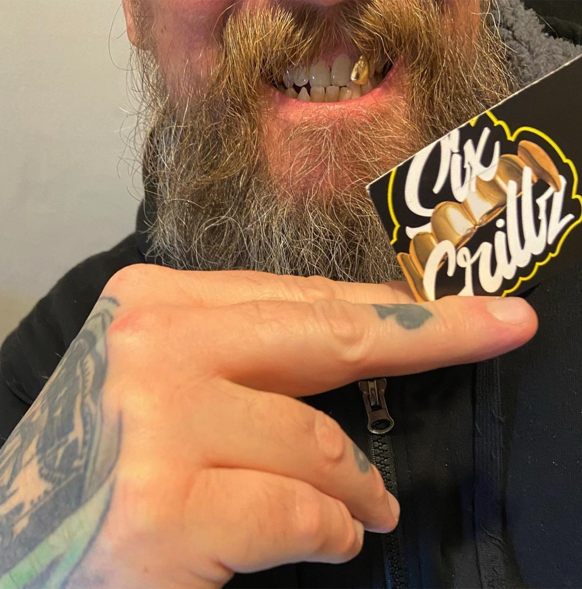 Gold Caps