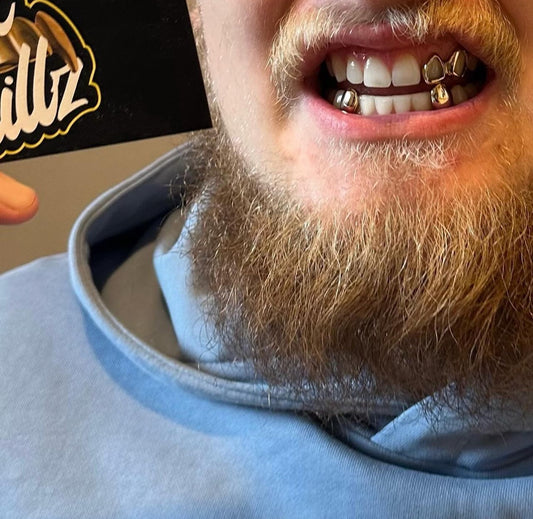 Gold Window Caps